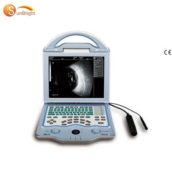 a/b сканирование офтальмологическое ультразвуковое SUN-AB, офтальмология, портативное офтальмологическое