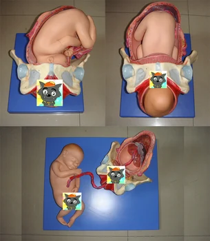 Модель процесса доношенных родов плода